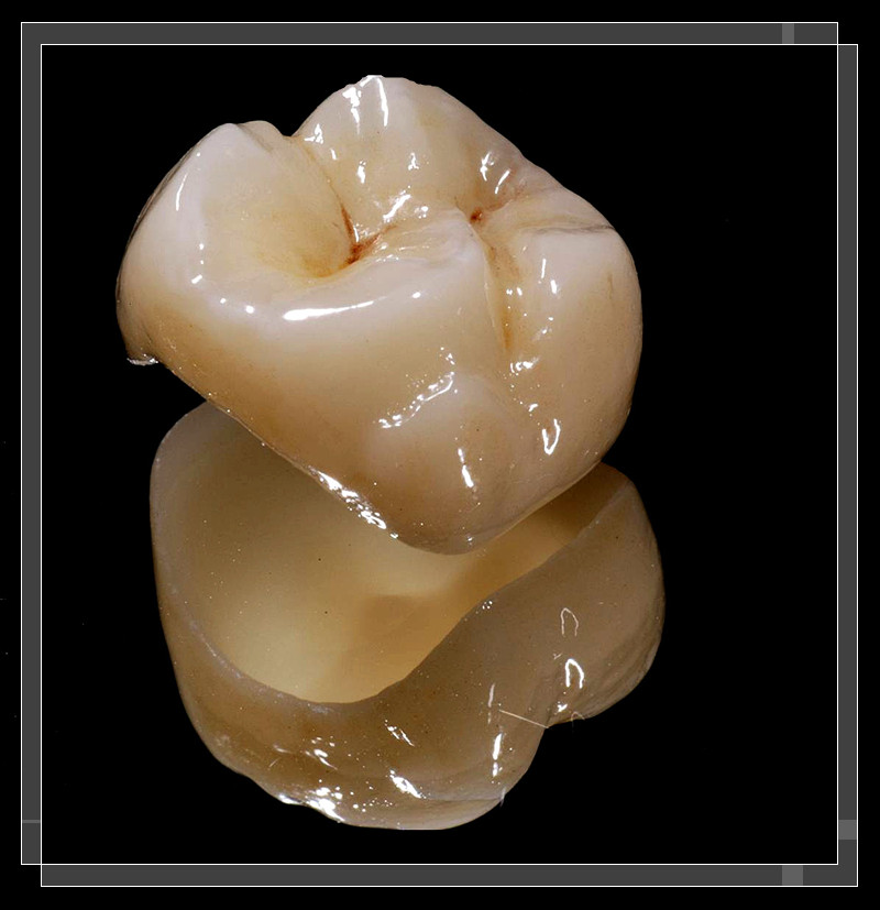 Proceso de producción de coronas de dientes posteriores de zirconia