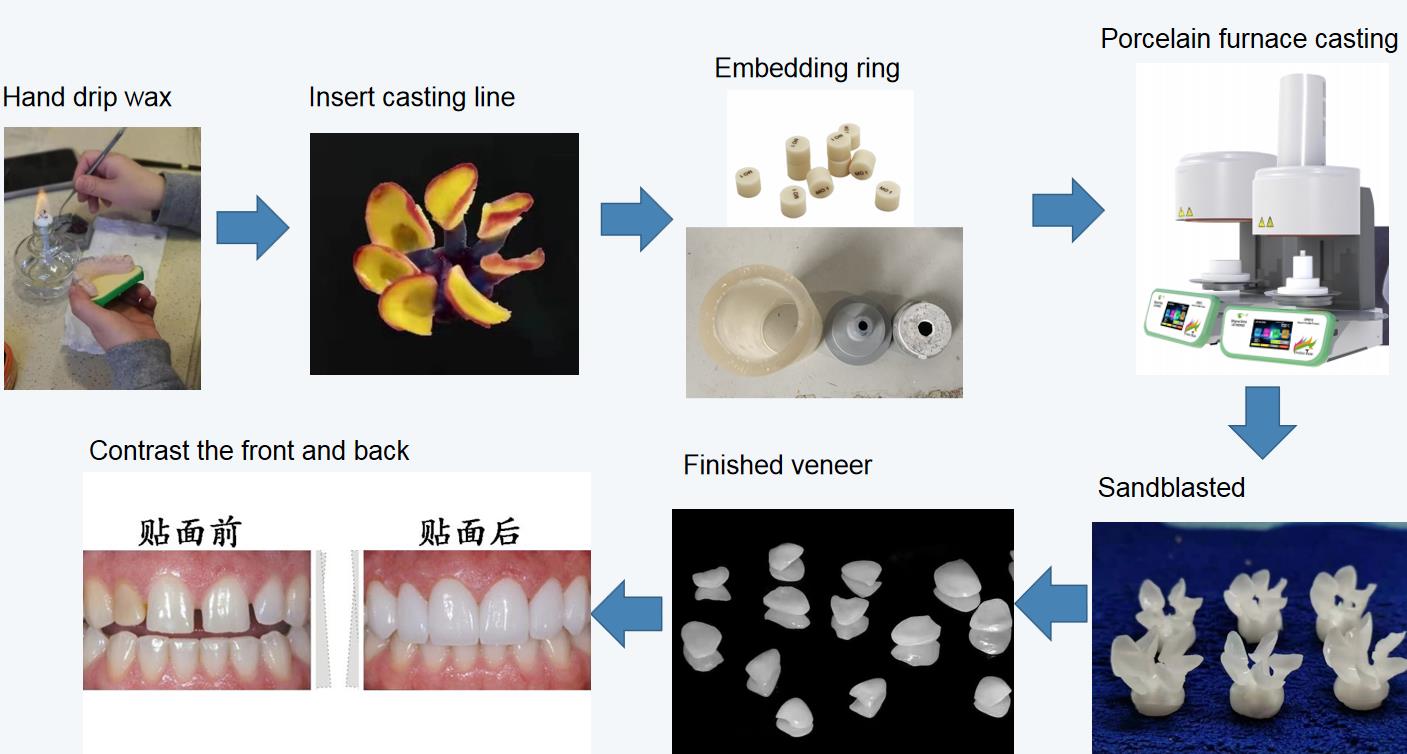 Laboratorio dental