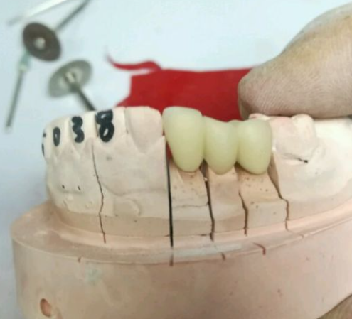 Laboratorio dental