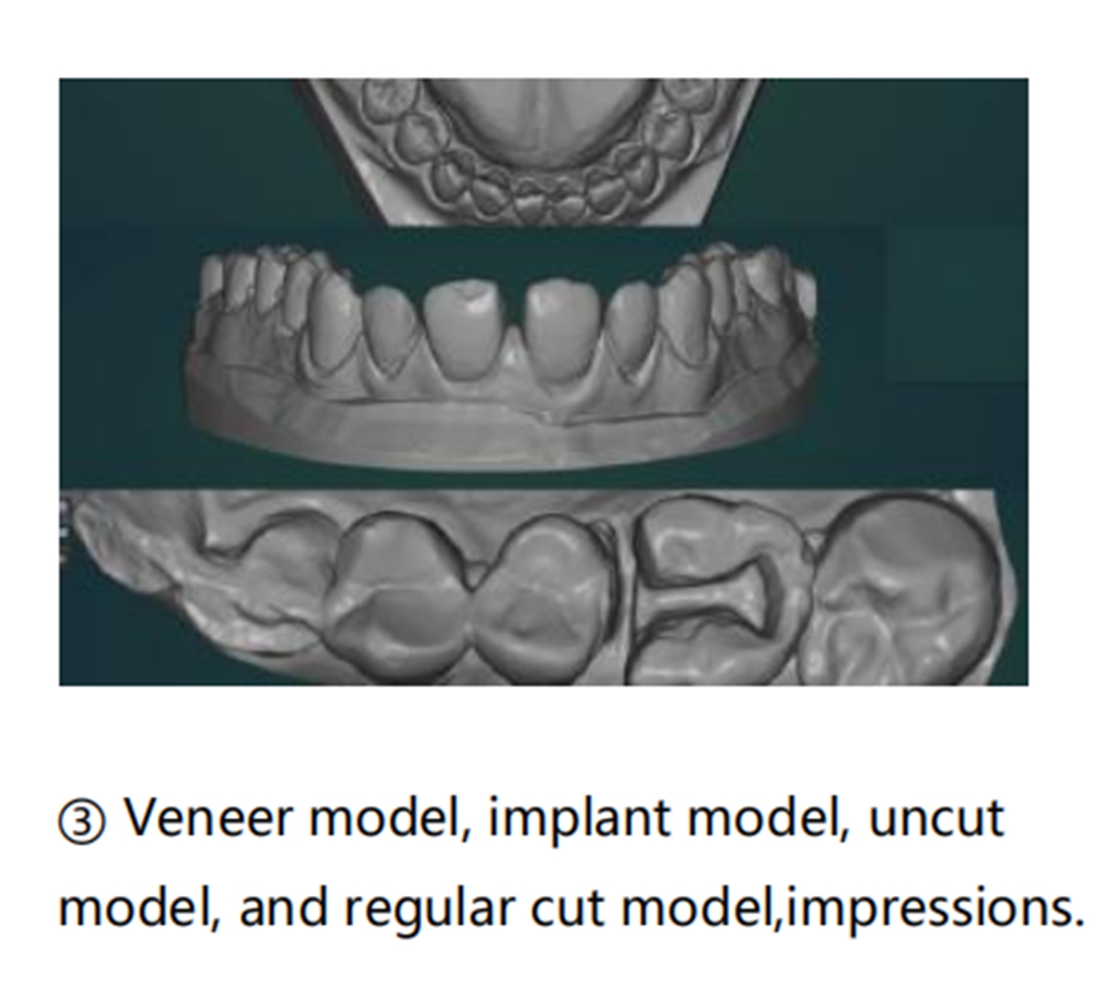 UP300E Dental Scanner