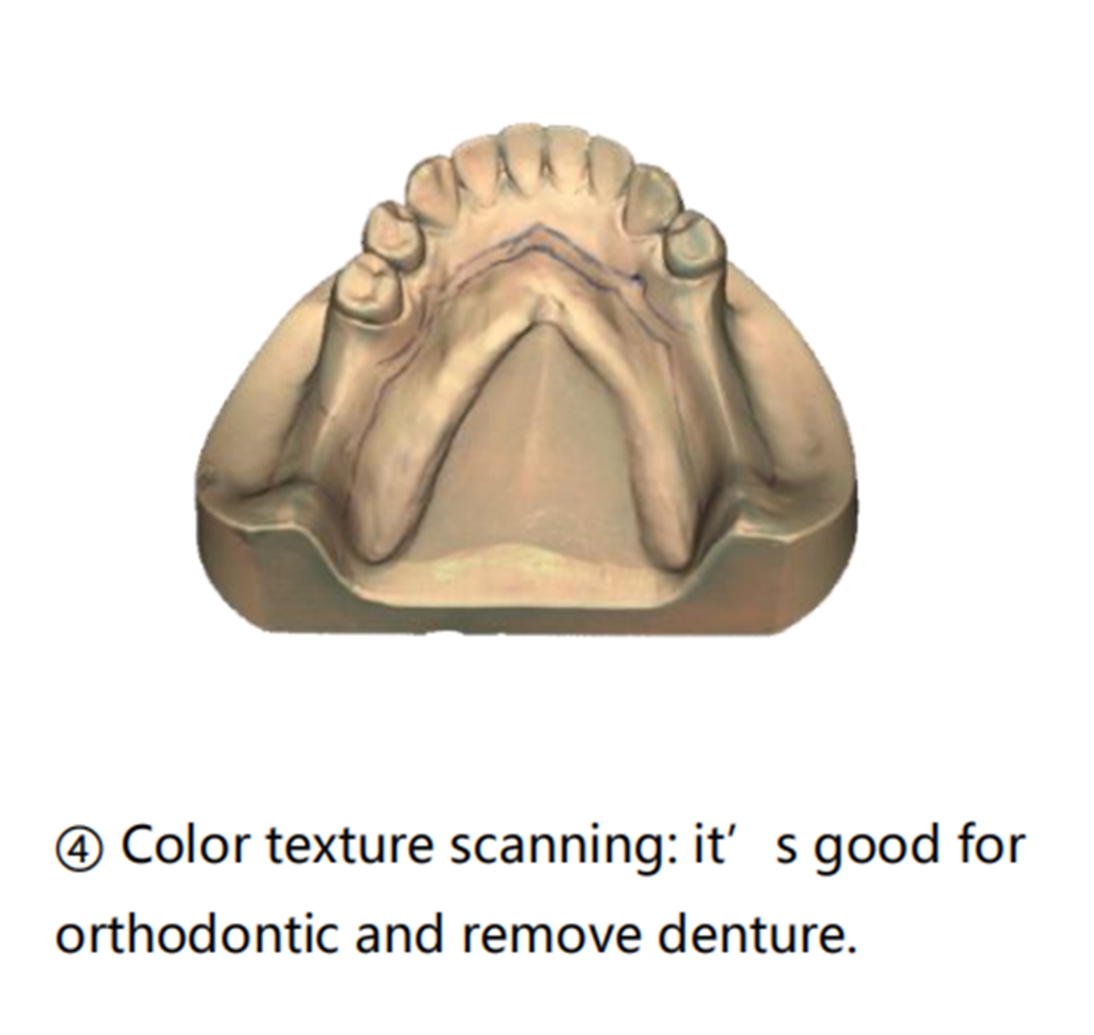 UP300E Dental Scanner