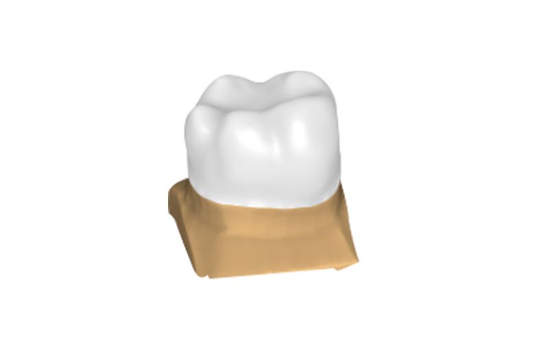 Proyecto de diseño general